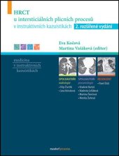 kniha HRCT u intersticiálních plicních procesů v instruktivních kazuistikách 2. rozšířené vydání, Maxdorf 2025
