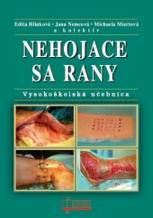 kniha Nehojace sa rany Vysokoškolská učebnica, Osveta 2015