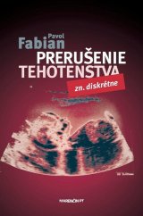 kniha Prerušenie tehotenstva zn. diskrétne, Marenčin PT 2012