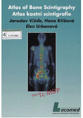 kniha Atlas kostní scintigrafie  Atlas of bone scintigraphy, Lacomed 2006