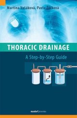 kniha Thoracic Drainage A Step-by-Step Guide, Maxdorf 2025