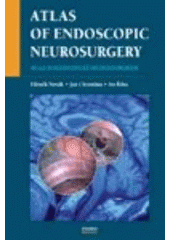 kniha Atlas of endoscopic neurosurgery = Atlas endoskopické neurochirurgie, Maxdorf 2007