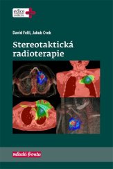 kniha Stereotaktická radioterapie, Mladá fronta 2019