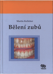 kniha Bělení zubů, Quintessenz 2008