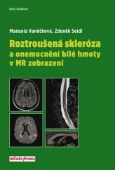 kniha Roztroušená skleróza a onemocnění bílé hmoty v MR zobrazení, Mladá fronta 2018