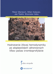 kniha Hodnotenie žilovej hemodynamiky po aloplastikách váhonosných kľbov počas tromboprofylaxie, Nucleus HK 2008