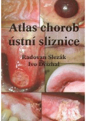 kniha Atlas chorob ústní sliznice, Quintessenz 2004