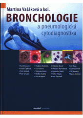 kniha Bronchologie a pneumologická cytodiagnostika, Maxdorf 2017