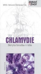 kniha Chlamydie skrytá hrozba v těle, Český klub 2009