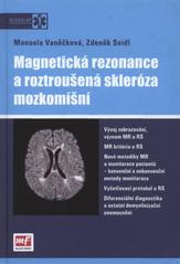 kniha Magnetická rezonance a roztroušená skleróza mozkomíšní, Mladá fronta 2010