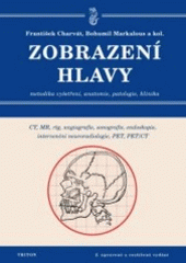 kniha Zobrazení hlavy metodika vyšetřování, anatomie, patologie, klinika : CT, MR, RTG, PET, PET/CT, sonografie, endoskopie, angiografie, intervenční neuroradiologie, navigovaná chirurgie, Triton 2006