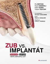 kniha Zub vs. implantát Zachovat, či nahradit vážně poškozený zub?, Grada 2025