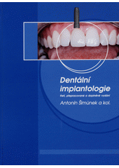 kniha Dentální implantologie, Artilis 2017