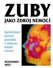 kniha Zuby jako zdroj nemocí rychlé léčení pomocí poznatků z výzkumu ložisek nemoci, Pragma 2009