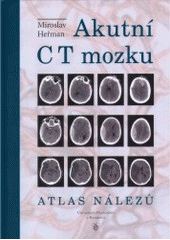 kniha Akutní CT mozku atlas nálezů, Univerzita Palackého 2006