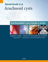 kniha Arachnoid cysts / Arachnoidální cysty mozku a míchy, Maxdorf 2013