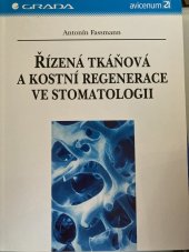 kniha Řízená tkáňová a kostní regenerace ve stomatologii, Grada 2002