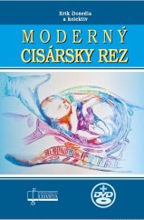 kniha Moderný cisársky rez, Osveta 2022