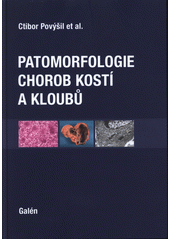 kniha Patomorfologie chorob kostí a kloubů, Galén 2017