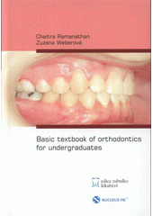 kniha Basic textbook of orthodontics for undergraduates, Nucleus HK 2008