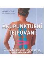 kniha Akupunkturní tejpování Účinné při akutních i chronických bolestech a potížích , Fontána 2014