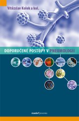 kniha Doporučené postupy v pneumologii, Maxdorf 2013