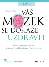 kniha Váš mozek se dokáže uzdravit Pozoruhodné případy léčby a uzdravení využívající neuroplasticity mozku, CPress 2017