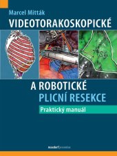 kniha Videotorakoskopické a robotické plicní resekce Praktický manuál, Maxdorf 2025
