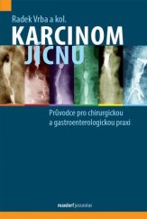 kniha Karcinom jícnu Průvodce pro chirurgickou a gastroenterologickou praxi, Maxdorf 2021
