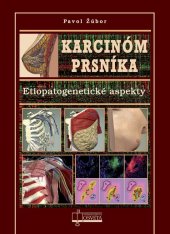 kniha Karcinóm prsníka Etiopatogenetické aspekty, Osveta 2014