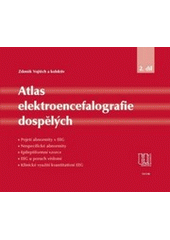 kniha Atlas elektroencefalografie dospělých. 2. díl, - Pojetí abnormity v EEG, nespecifické abnormity, epileptiformní vzorce, EEG u poruch vědomí, klinické využití kvantitativní EEG, Triton 2006