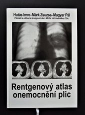 kniha Rentgenový atlas onemocnění plic, Novartis 1999