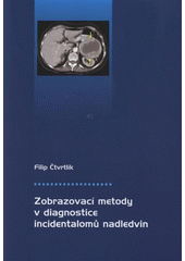 kniha Zobrazovací metody v diagnostice incidentalomů nadledvin, Univerzita Palackého v Olomouci 2008