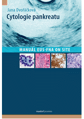 kniha Cytologie pankreatu manuál EUS-FNA on site, Maxdorf 2013