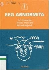 kniha EEG abnormita, Maxdorf 2006
