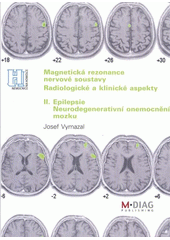 kniha Magnetická rezonance nervové soustavy II., - Epilepsie, neurodegenerativní onemocnění mozku - radiologické a klinické aspekty., M-DIAG 2009