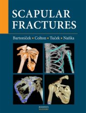 kniha Scapular fractures, Maxdorf 2022