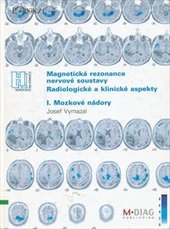 kniha Magnetická rezonance nervové soustavy I., - Mozkové nádory - radiologické a klinické aspekty., M-DIAG 2006
