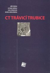 kniha CT trávicí trubice, Galén 2006