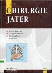 kniha Chirurgie jater, Maxdorf 2004
