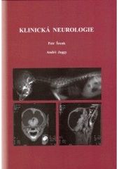 kniha Klinická neurologie, Noviko 2000