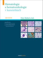 kniha Hematologie a hematoonkologie v kazuistikách Medicína v instruktivních kazuistikách, Maxdorf 2021