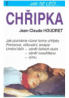 Chřipka