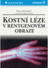 Kostní léze v rentgenovém obraze