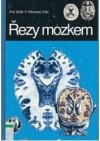 Řezy mozkem