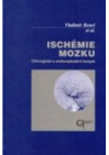 Ischémie mozku