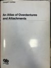An Atlas of Overdentures and Attachments