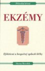 Ekzémy