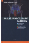 Anální spinocelulární karcinom