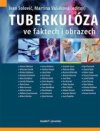 Tuberkulóza ve faktech i obrazech